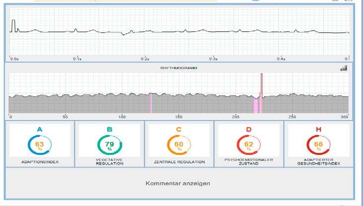 Auswertung + Analyse einer HRV Messung 